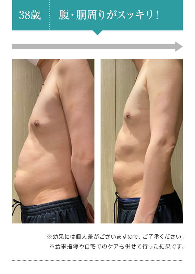38歳：腹・胴周りがスッキリ！