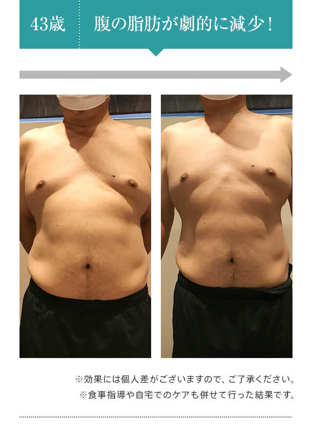 43歳：腹の脂肪が劇的に減少！