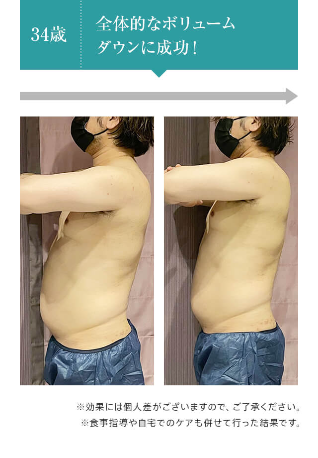 34歳：全体的なボリュームダウンに成功！