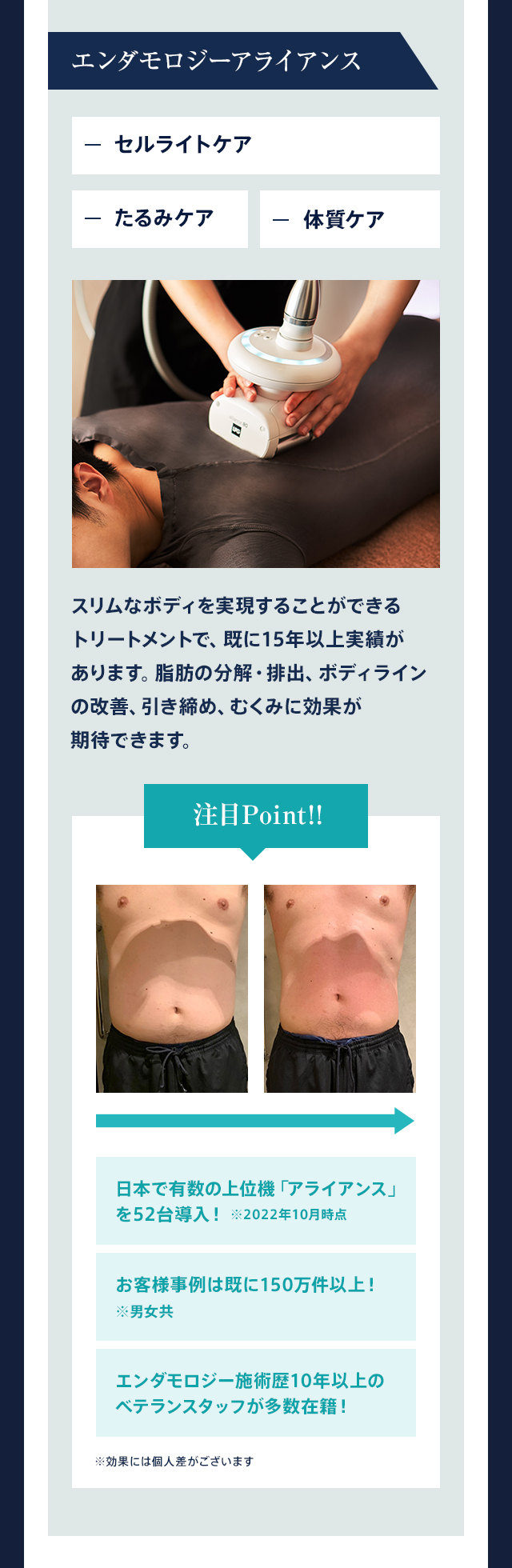 エンダモロジーアライアンスでセルライトケア・たるみケア・体質ケア